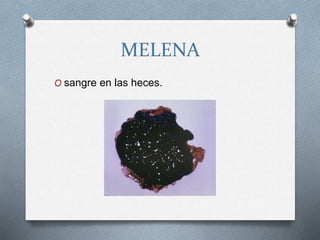 MELENA
O sangre en las heces.
 