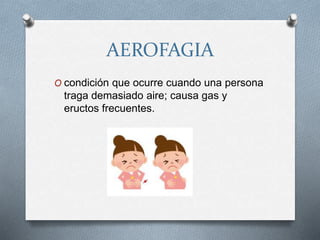 AEROFAGIA
O condición que ocurre cuando una persona
traga demasiado aire; causa gas y
eructos frecuentes.
 