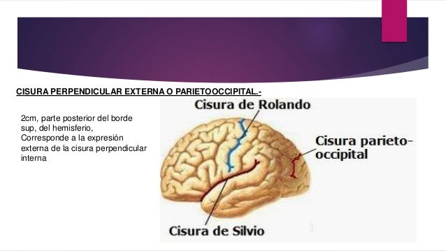 CEREBRO