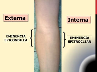 EMINENCIA
EPICONDILEA
EMINENCIA
EPITROCLEAR
Externa Interna
 