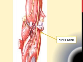 Nervio cubital
 