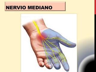 NERVIO MEDIANO
 