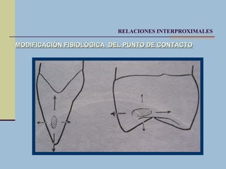 Anato arcos hasta relac interprox | PPT