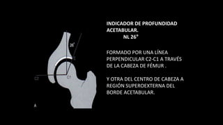 INDICADOR DE PROFUNDIDAD
ACETABULAR.
NL 26°
FORMADO POR UNA LÍNEA
PERPENDICULAR C2-C1 A TRAVÉS
DE LA CABEZA DE FÉMUR .
Y OTRA DEL CENTRO DE CABEZA A
REGIÓN SUPEROEXTERNA DEL
BORDE ACETABULAR.
 