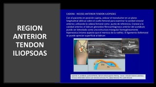REGION
ANTERIOR
TENDON
ILIOPSOAS
 