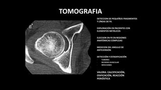 TOMOGRAFIA
DETECCION DE PEQUEÑOS FRAGMENTOS
Y LÍNEAS DE FX.
EXPLORACIÓN EN PACIENTES CON
ELEMENTOS METÁLICOS
ELECCION EN FX EN REGIONES
ANATÓMICAS COMPLEJAS
MEDICION DEL ANGULO DE
ANTEVERSIÓN
DETECCIÓN Y ESTADIFICACIÓN
- TUMORES
- NECROSIS AVASCULAR
- INFECCIONES
VALORA: CALCIFICACIÓN,
OSIFICACIÓN, REACCIÓN
PERIÓSTICA
 