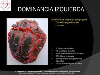 DOMINANCIA IZQUIERDA Dominancia izquierda subgrupo II. Cara diafragmática del corazón. VI.  Ventrículo izquierdo;  VD.  Ventrículo derecho;  RIP  Rama interventricular posterior.  RCX.  Rama circunfleja. * Ramas ventriculares posteriores izquierdas; Flecha.  Rama marginal izquierda. L. Ballesteros; E. Corzo y colaboradores, “  Coronary's Dominance Determination in Racially Mixed Colombian Population” A Direct Anatomical Study,  Int. J. Morphol.25(3) :483-491, 2007     