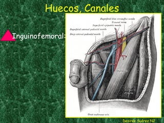 Huecos, Canales Desirée Suárez N2 Inguinofemoral:  