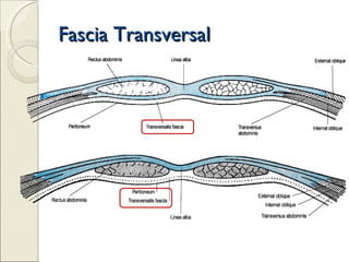Fascia Transversal 