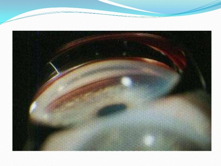 Anatomía túnica fibrosa