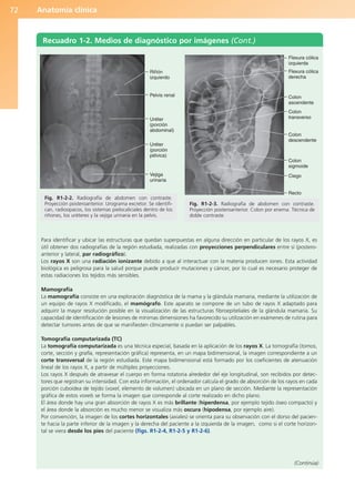 Anatomía clínica
72
Para identificar y ubicar las estructuras que quedan superpuestas en alguna dirección en particular de los rayos X, es
útil obtener dos radiografías de la región estudiada, realizadas con proyecciones perpendiculares entre sí (postero-
anterior y lateral, par radiográfico).
Los rayos X son una radiación ionizante debido a que al interactuar con la materia producen iones. Esta actividad
biológica es peligrosa para la salud porque puede producir mutaciones y cáncer, por lo cual es necesario proteger de
estas radiaciones los tejidos más sensibles.
Mamografía
La mamografía consiste en una exploración diagnóstica de la mama y la glándula mamaria, mediante la utilización de
un equipo de rayos X modificado, el mamógrafo. Este aparato se compone de un tubo de rayos X adaptado para
adquirir la mayor resolución posible en la visualización de las estructuras fibroepiteliales de la glándula mamaria. Su
capacidad de identificación de lesiones de mínimas dimensiones ha favorecido su utilización en exámenes de rutina para
detectar tumores antes de que se manifiesten clínicamente o puedan ser palpables.
Tomografía computarizada (TC)
La tomografía computarizada es una técnica especial, basada en la aplicación de los rayos X. La tomografía (tomos,
corte, sección y grafía, representación gráfica) representa, en un mapa bidimensional, la imagen correspondiente a un
corte transversal de la región estudiada. Este mapa bidimensional está formado por los coeficientes de atenuación
lineal de los rayos X, a partir de múltiples proyecciones.
Los rayos X después de atravesar el cuerpo en forma rotatoria alrededor del eje longitudinal, son recibidos por detec-
tores que registran su intensidad. Con esta información, el ordenador calcula el grado de absorción de los rayos en cada
porción cuboidea de tejido (voxel, elemento de volumen) ubicada en un plano de sección. Mediante la representación
gráfica de estos voxels se forma la imagen que corresponde al corte realizado en dicho plano.
El área donde hay una gran absorción de rayos X es más brillante (hiperdensa, por ejemplo tejido óseo compacto) y
el área donde la absorción es mucho menor se visualiza más oscura (hipodensa, por ejemplo aire).
Por convención, la imagen de los cortes horizontales (axiales) se orienta para su observación con el dorso del pacien-
te hacia la parte inferior de la imagen y la derecha del paciente a la izquierda de la imagen, como si el corte horizon-
tal se viera desde los pies del paciente (figs. R1-2-4, R1-2-5 y R1-2-6).
Recuadro 1-2. Medios de diagnóstico por imágenes (Cont.)
(Continúa)
Riñón
izquierdo
Pelvis renal
Uréter
(porción
abdominal)
Uréter
(porción
pélvica)
Vejiga
urinaria
Fig. R1-2-2. Radiografía de abdomen con contraste.
Proyección posteroanterior. Urograma excretor. Se identifi-
can, radioopacos, los sistemas pielocaliciales dentro de los
riñones, los uréteres y la vejiga urinaria en la pelvis.
Flexura cólica
izquierda
Flexura cólica
derecha
Colon
ascendente
Colon
transverso
Colon
descendente
Colon
sigmoide
Ciego
Recto
Fig. R1-2-3. Radiografía de abdomen con contraste.
Proyección posteroanterior. Colon por enema. Técnica de
doble contraste.
b027-01.qxd 7/14/11 12:50 PM Page 72
ERRNVPHGLFRVRUJ
 