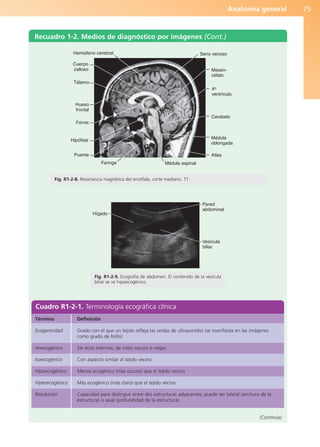 Anatomía general 75
Recuadro 1-2. Medios de diagnóstico por imágenes (Cont.)
(Continúa)
Vesícula
biliar
Hígado
Pared
abdominal
Fig. R1-2-9. Ecografía de abdomen. El contenido de la vesícula
biliar se ve hipoecogénico.
Cuadro R1-2-1. Terminología ecográfica clínica
Término
Ecogenicidad
Anecogénico
Isoecogénico
Hipoecogénico
Hiperecogénico
Resolución
Definición
Grado con el que un tejido refleja las ondas de ultrasonidos (se manifiesta en las imágenes
como grado de brillo)
Sin ecos internos, de color oscuro o negro
Con aspecto similar al tejido vecino
Menos ecogénico (más oscuro) que el tejido vecino
Más ecogénico (más claro) que el tejido vecino
Capacidad para distinguir entre dos estructuras adyacentes; puede ser lateral (anchura de la
estructura) o axial (profundidad de la estructura)
Seno venoso
Cuerpo
calloso Mesen-
céfalo
4o
ventrículo
Cerebelo
Médula
oblongada
Atlas
Médula espinal
Hemisferio cerebral
Tálamo
Hueso
frontal
Fórnix
Hipófisis
Puente
Faringe
Fig. R1-2-8. Resonancia magnética del encéfalo, corte mediano. T1.
b027-01.qxd 7/14/11 12:50 PM Page 75
ERRNVPHGLFRVRUJ
 