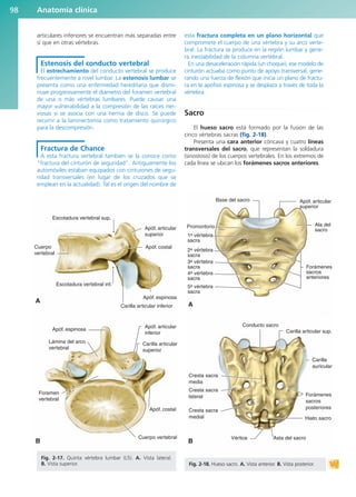 articulares inferiores se encuentran más separadas entre
sí que en otras vértebras.
Estenosis del conducto vertebral
El estrechamiento del conducto vertebral se produce
frecuentemente a nivel lumbar. La estenosis lumbar se
presenta como una enfermedad hereditaria que dismi-
nuye progresivamente el diámetro del foramen vertebral
de una o más vértebras lumbares. Puede causar una
mayor vulnerabilidad a la compresión de las raíces ner-
viosas si se asocia con una hernia de disco. Se puede
recurrir a la laminectomía como tratamiento quirúrgico
para la descompresión.
Fractura de Chance
A esta fractura vertebral también se la conoce como
“fractura del cinturón de seguridad”. Antiguamente los
automóviles estaban equipados con cinturones de segu-
ridad transversales (en lugar de los cruzados que se
emplean en la actualidad). Tal es el origen del nombre de
esta fractura completa en un plano horizontal que
compromete el cuerpo de una vértebra y su arco verte-
bral. La fractura se produce en la región lumbar y gene-
ra inestabilidad de la columna vertebral.
En una desaceleración rápida (un choque), ese modelo de
cinturón actuaba como punto de apoyo transversal, gene-
rando una fuerza de flexión que inicia un plano de fractu-
ra en la apófisis espinosa y se desplaza a través de toda la
vértebra.
Sacro
El hueso sacro está formado por la fusión de las
cinco vértebras sacras (fig. 2-18).
Presenta una cara anterior cóncava y cuatro líneas
transversales del sacro, que representan la soldadura
(sinostosis) de los cuerpos vertebrales. En los extremos de
cada línea se ubican los forámenes sacros anteriores.
Anatomía clínica
98
Escotadura vertebral sup.
Escotadura vertebral inf.
A
B
Apóf. articular
superior
Apóf. costal
Cuerpo
vertebral
Apóf. espinosa
Carilla articular inferior
Lámina del arco
vertebral
Apóf. costal
Apóf. espinosa
Foramen
vertebral
Cuerpo vertebral
Apóf. articular
inferior
Carilla articular
superior
Fig. 2-17. Quinta vértebra lumbar (L5). A. Vista lateral.
B. Vista superior.
Apóf. articular
superior
Base del sacro
Promontorio
A
B
1a vértebra
sacra
2a vértebra
sacra
3a vértebra
sacra
4a vértebra
sacra
5a vértebra
sacra
Cresta sacra
media
Asta del sacro
Hiato sacro
Vértice
Cresta sacra
medial
Carilla
auricular
Cresta sacra
lateral
Conducto sacro
Ala del
sacro
Forámenes
sacros
anteriores
Forámenes
sacros
posteriores
Carilla articular sup.
Fig. 2-18. Hueso sacro. A. Vista anterior. B. Vista posterior.
b027-02.qxd 7/12/11 8:38 AM Page 98
ERRNVPHGLFRVRUJ
 