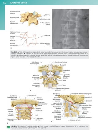 Anatomía clínica
102
A
B
Apófisis articular
superior
Apófisis costal
Porción
interarticular
Lámina
Apófisis espinosa
Apófisis articular
inferior
Apófisis articular
superior
Apófisis
costal
Pedículo
Porción
interarticular
Lámina
Apófisis articular
inferior
C
Fig. 2-23. A. Vista oblicua posterior izquierda de la cuarta vértebra lumbar, que permite compararla con la imagen que se obser-
va en la radiografía. B. Esquema de la silueta de un “perro terrier escocés” formado por la suma de las radiopacidades de la
vértebra. C. Radiografía de la columna lumbar, proyección oblicua anteroposterior derecha, donde se delimita la imagen del
“perro terrier escocés” o “perro de Lachapelle”.
Membrana tectoria
Articulación
atlantooccipital
Occipital
Ligamento
alar
Ligamento
transverso
del atlas
Atlas
Axis
Ligamento longitudinal
posterior
A
Fascículo
longitudinal
inferior
Fascículo
longitudinal
superior
Arteria basilar
Hueso
occipital
Apófisis
transversa
Axis
3a
vértebra
cervical
Membrana
atlantooccipital
posterior
1er
nervio
cervical
Arteria
vertebral
Ligamento
amarillo
Ligamento
atlantooccipital
lateral
B
Ligamento
transverso del atlas
Membrana
tectoria
Fascículo
longitudinal
superior
Ligamento del
vértice del diente
Arco anterior
del atlas
Conducto del nervio hipogloso
Occipital
Arteria vertebral
Arco posterior
del atlas
Ligamento
amarillo
Ligamento
longitudinal posterior
Ligamento
longitudinal
anterior
Cuerpo del axis
Articulación
atlantoaxoidea
media
C
Fig. 2-24. Articulaciones craneovertebrales. A. Corte coronal a nivel del foramen magno, vista posterior de los ligamentos pro-
fundos. B. Vista posterior. C. Corte sagital, vista izquierda.
b027-02.qxd 7/12/11 8:38 AM Page 102
ERRNVPHGLFRVRUJ
 