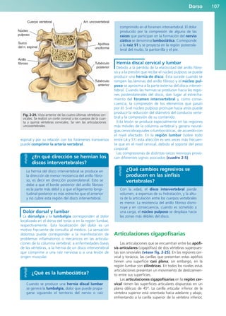 Dorso 107
espinal y por su relación con los forámenes transversos
puede comprimir la arteria vertebral.
La hernia del disco intervertebral se produce en
la dirección de menor resistencia del anillo fibro-
so, es decir en dirección posterolateral. Esto se
debe a que el borde posterior del anillo fibroso
es la parte más débil y a que el ligamento longi-
tudinal posterior es más estrecho que el anterior
y no cubre esta región del disco intervertebral.
Dolor dorsal y lumbar
La dorsalgia y la lumbalgia corresponden al dolor
localizado en el dorso del toráx o en la región lumbar,
respectivamente. Esta localización del dolor es un
motivo frecuente de consulta al médico. La sensación
dolorosa puede corresponder a la manifestación de
problemas inflamatorios o mecánicos en las articula-
ciones de la columna vertebral, a enfermedades óseas
de las vértebras, a la hernia de un disco intervertebral
que comprime a una raíz nerviosa o a una lesión de
origen muscular.
Cuando se produce una hernia discal lumbar
se genera la lumbalgia, dolor que puede propa-
garse siguiendo el territorio del nervio o raíz
comprimido en el foramen intervertebral. El dolor
producido por la compresión de alguna de las
raíces que participan en la formación del nervio
ciático se denomina lumbociática. Corresponde
a la raíz S1 y se proyecta en la región posterola-
teral del muslo, la pantorrilla y el pie.
Hernia discal cervical y lumbar
Debido a la pérdida de la elasticidad del anillo fibro-
so y a la presión que recibe el núcleo pulposo se puede
producir una hernia de disco. Ésta sucede cuando se
rompen las láminas del anillo fibroso y el núcleo pul-
poso se aproxima a la parte externa del disco interver-
tebral. Cuando las hernias se producen hacia las regio-
nes posterolaterales del disco, dan lugar al estrecha-
miento del foramen intervertebral y, como conse-
cuencia, la compresión de los elementos que pasan
por él. Si el núcleo pulposo protruye hacia atrás puede
producir la reducción del diámetro del conducto verte-
bral y la compresión de su contenido.
Esta lesión se produce especialmente en las regiones
más móviles de la columna vertebral y genera neural-
gias cervicobraquiales o lumbociáticas, de acuerdo con
el nivel afectado. En la región lumbar (sobre todo
entre L4 y S1) esta afección es seis veces más frecuen-
te que en el nivel cervical, debido al soporte del peso
corporal.
Las compresiones de distintas raíces nerviosas provo-
can diferentes signos asociados (cuadro 2-5).
Con la edad, el disco intervertebral pierde
volumen, a expensas de su hidratación, y la altu-
ra de la articulación entre los cuerpos vertebrales
es menor. La resistencia del anillo fibroso dismi-
nuye y en consecuencia, cuando es sometido a
una carga, el núcleo pulposo se desplaza hacia
las zonas más débiles del disco.
Articulaciones cigapofisarias
Las articulaciones que se encuentran entre las apófi-
sis articulares (cigapófisis) de dos vértebras superpues-
tas son sinoviales (véase fig. 2-25). En las regiones cer-
vical y torácica, las carillas que presentan estas apófisis
tienen una superficie casi plana; sin embargo, en la
región lumbar son cilíndricas. En todos los niveles estas
articulaciones presentan un movimiento de deslizamien-
to entre sus superficies.
Las articulaciones cigapofisarias en la región cer-
vical tienen las superficies articulares dispuestas en un
plano oblicuo de 45°. La carilla articular inferior de la
vértebra superior está orientada hacia adelante y abajo,
enfrentando a la carilla superior de la vértebra inferior,
Núcleo
pulposo
Apófisis
unciforme
Tubérculo
posterior
Tubérculo
anterior
Art. uncovertebral
Cuerpo vertebral
Surco
del n. espinal
Anillo
fibroso
Fig. 2-29. Vista anterior de las cuatro últimas vértebras cer-
vicales. Se realizó un corte coronal a los cuerpos de la cuar-
ta y quinta vértebras cervicales. Se ven las articulaciones
uncovertebrales.
¿En qué dirección se hernian los
discos intervertebrales?
¿Qué es la lumbociática?
¿Qué cambios regresivos se
producen en las sínfisis
vertebrales?
b027-02.qxd 7/12/11 8:38 AM Page 107
ERRNVPHGLFRVRUJ
 