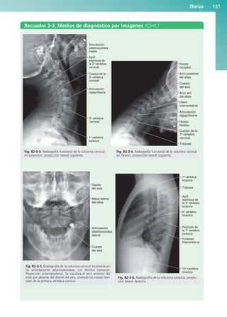 Dorso 131
Recuadro 2-3. Medios de diagnóstico por imágenes (Cont.)
6a
vértebra
cervical
Apóf.
espinosa de
la 2a
vértebra
cervical
Cuerpo de la
3a
vértebra
cervical
Articulación
cigapofisaria
Articulación
atlantoaxoidea
media
1a
vértebra
torácica
Fig. R2-3-3. Radiografía funcional de la columna cervical
en extensión, proyección lateral izquierda.
Diente
del axis
Cuerpo
del axis
Articulación
atlantoaxoidea
lateral
Masa lateral
del atlas
Fig. R2-3-5. Radiografía de la columna cervical focalizada en
las articulaciones atlantoaxoideas, con técnica transoral.
Proyección anteroposterior. Se visualiza el arco anterior del
atlas por delante del diente del axis, uniendo las masas late-
rales de la primera vértebra cervical.
Hueso
occipital
Arco posterior
del atlas
Cuerpo
del axis
Arco ant.
del atlas
Disco
intervertebral
Articulación
cigapofisaria
Hueso
hioides
Tráquea
Cuerpo de la
7a
vértebra
cervical
Fig. R2-3-4. Radiografía funcional de la columna cervical
en flexión, proyección lateral izquierda.
Tráquea
Apóf.
espinosa de
la 4a
vértebra
torácica
1a
vértebra
torácica
6a
vértebra
torácica
Pedículo de
la 7a
vértebra
torácica
Foramen
intervertebral
12a
vértebra
torácica
Fig. R2-3-6. Radiografía de la columna torácica, proyec-
ción lateral derecha.
b027-02.qxd 7/12/11 8:39 AM Page 131
ERRNVPHGLFRVRUJ
 