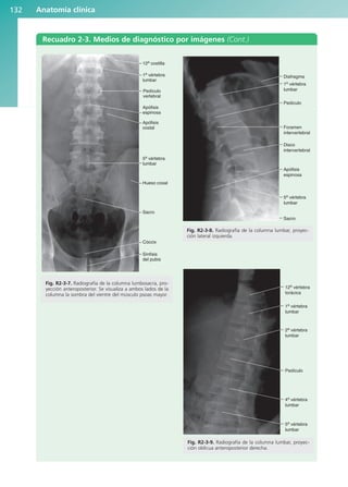 Anatomía clínica
132
Recuadro 2-3. Medios de diagnóstico por imágenes (Cont.)
12a costilla
1a
vértebra
lumbar
Pedículo
vertebral
Apófisis
costal
Apófisis
espinosa
5a
vértebra
lumbar
Hueso coxal
Sacro
Cóccix
Sínfisis
del pubis
Fig. R2-3-7. Radiografía de la columna lumbosacra, pro-
yección anteroposterior. Se visualiza a ambos lados de la
columna la sombra del vientre del músculo psoas mayor.
Diafragma
1a
vértebra
lumbar
Pedículo
Foramen
intervertebral
Disco
intervertebral
Apófisis
espinosa
5a
vértebra
lumbar
Sacro
Fig. R2-3-8. Radiografía de la columna lumbar, proyec-
ción lateral izquierda.
12a
vértebra
torácica
1a
vértebra
lumbar
2a
vértebra
lumbar
Pedículo
4a
vértebra
lumbar
5a
vértebra
lumbar
Fig. R2-3-9. Radiografía de la columna lumbar, proyec-
ción oblicua anteroposterior derecha.
b027-02.qxd 7/12/11 8:39 AM Page 132
ERRNVPHGLFRVRUJ
 