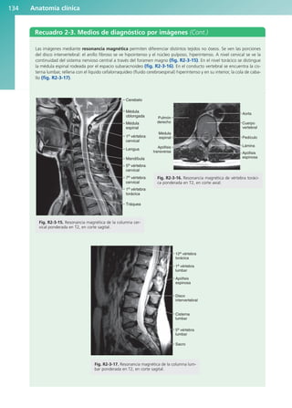 Anatomía clínica
134
Recuadro 2-3. Medios de diagnóstico por imágenes (Cont.)
Las imágenes mediante resonancia magnética permiten diferenciar distintos tejidos no óseos. Se ven las porciones
del disco intervertebral: el anillo fibroso se ve hipointenso y el núcleo pulposo, hiperintenso. A nivel cervical se ve la
continuidad del sistema nervioso central a través del foramen magno (fig. R2-3-15). En el nivel torácico se distingue
la médula espinal rodeada por el espacio subaracnoideo (fig. R2-3-16). En el conducto vertebral se encuentra la cis-
terna lumbar, rellena con el líquido cefalorraquídeo (fluido cerebroespinal) hiperintenso y en su interior, la cola de caba-
llo (fig. R2-3-17).
Fig. R2-3-15. Resonancia magnética de la columna cer-
vical ponderada en T2, en corte sagital.
Cerebelo
Médula
oblongada
Médula
espinal
1a vértebra
cervical
Lengua
Mandíbula
5a
vértebra
cervical
7a
vértebra
cervical
1a vértebra
torácica
Tráquea
Fig. R2-3-16. Resonancia magnética de vértebra toráci-
ca ponderada en T2, en corte axial.
Pulmón
derecho
Aorta
Cuerpo
vertebral
Pedículo
Lámina
Apófisis
espinosa
Médula
espinal
Apófisis
transversa
Fig. R2-3-17. Resonancia magnética de la columna lum-
bar ponderada en T2, en corte sagital.
12a
vértebra
torácica
1a vértebra
lumbar
Apófisis
espinosa
Disco
intervertebral
Cisterna
lumbar
5a
vértebra
lumbar
Sacro
b027-02.qxd 7/12/11 8:39 AM Page 134
ERRNVPHGLFRVRUJ
 