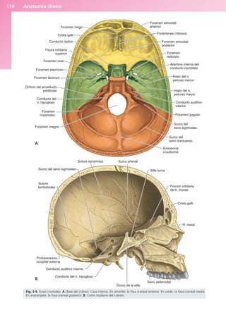 Anatomía clínica
174
Foramen ciego
Crista galli
Conducto óptico
Fisura orbitaria
superior
Foramen oval
Foramen espinoso
Foramen lacerum
Orificio del acueducto
vestibular
Conducto del
n. hipogloso
Foramen
mastoideo
Foramen magno
Eminencia
cruciforme
Surco del
seno transverso
Surco del
seno sigmoideo
Foramen yugular
Conducto auditivo
interno
Hiato del n.
petroso mayor
Hiato del n.
petroso menor
Abertura interna del
conducto carotídeo
Foramen
redondo
Foramen etmoidal
posterior
Forámenes cribosos
Foramen etmoidal
anterior
Sutura escamosa
Surco del seno sigmoideo
Sutura
lambdoidea
Protuberancia
occipital externa
Conducto auditivo interno
Conducto del n. hipogloso
Dorso de la silla
Seno esfenoidal
H. nasal
Crista galli
Porción orbitaria
del h. frontal
Silla turca
Surco arterial
Fig. 3-5. Fosas craneales. A. Base del cráneo. Cara interna. En amarillo: la fosa craneal anterior. En verde: la fosa craneal media.
En anaranjado: la fosa craneal posterior. B. Corte mediano del cráneo.
A
B
b027-03.qxd 7/12/11 2:36 PM Page 174
ERRNVPHGLFRVRUJ
 