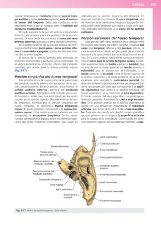 Cabeza 185
cavidad timpánica: un conducto (inferior) para la trom-
pa auditiva y otro conducto (superior) para el múscu-
lo tensor del tímpano. Estos dos conductos están
separados entre sí por un tabique óseo: el tabique del
conducto musculotubárico.
El borde superior de la porción petrosa está ubicado
entre la cara anterior y la cara posterior de la porción
petrosa. En este borde encontramos el surco del seno
petroso superior, que aloja al seno venoso homónimo.
En el borde posterior de la porción petrosa del tem-
poral encontramos el surco para el seno petroso infe-
rior y la escotadura yugular, que forma el borde ante-
rior del foramen yugular.
El vértice de la porción petrosa está orientado en
dirección anteromedial y contacta con el esfenoides. En
el vértice encontramos el orificio interno del conducto
carotídeo, por donde pasa la arteria carótida interna
(fig. 3-17).
Porción timpánica del hueso temporal
Esta porción forma la mayor parte de la pared ósea
del conducto auditivo externo con excepción de su por-
ción posterosuperior. En esta porción encontramos el
orificio auditivo externo, apertura del conducto
auditivo externo. Este orificio está rodeado por el ani-
llo timpánico, anillo óseo que está abierto en los recién
nacidos en su porción superior. El borde anterior del ani-
llo timpánico, formado por la porción timpánica del
hueso temporal, se denomina espina timpánica
mayor. El borde posterior corresponde a la espina tim-
pánica menor. Entre ambas espinas podemos ver una
convexidad, la escotadura timpánica. En los recién
nacidos corresponde al espacio entre los extremos supe-
riores del anillo timpánico incompleto, que luego es
rellenada por la porción escamosa del temporal. En
dirección medial encontramos el surco timpánico, sitio
de inserción de la membrana timpánica. La porción tim-
pánica del hueso temporal que rodea a la raíz de la apó-
fisis estiloides corresponde a la vaina de la apófisis
estiloides.
Porción escamosa del hueso temporal
Esta porción del hueso temporal está ubicada entre
los huesos esfenoides, parietal y occipital. Presenta dos
caras: una temporal, externa, y otra cerebral, interna. La
cara temporal está cubierta en gran parte por el músculo
temporal y la cara cerebral está orientada hacia el encé-
falo. En la cara cerebral, ligeramente cóncava, encontra-
mos el surco para la arteria temporal media. La por-
ción escamosa tiene un borde superior o parietal, que
se articula con el hueso parietal, un borde anterior o
esfenoidal que se articula con el esfenoides, y un
borde posterior u occipital. Entre el borde superior de
la apófisis mastoides y el borde posterior de la porción
escamosa está ubicada la escotadura parietal. En
dirección anterior la porción escamosa del temporal pre-
senta una proyección ósea que corresponde a la apófi-
sis cigomática que, junto a la apófisis temporal del
hueso cigomático, va a conformar el arco cigomático.
El borde superior del arco cigomático se prolonga en
dirección posterior formando la cresta supramastoi-
dea. En la porción anterior de la apófisis cigomática se
puede ver una proyección redondeada: el tubérculo
articular, por detrás del cual se halla la fosa mandibu-
lar, fosa articular para la articulación temporomandibu-
lar, que presenta en su interior la superficie articular
para la cabeza de la mandíbula. Continuando en direc-
ción posterior, algunas veces podemos encontrar la espi-
Borde esfenoidal
Vértice de la
porción petrosa
Abertura interna del
conducto carotídeo
Abertura externa del
conducto carotídeo
Conductillo timpánico
Fosa yugular
Apóf. estiloides
Surco de la a.
occipital
Foramen mastoideo
Escotadura mastoidea
Apóf. mastoides
Foramen estilomastoideo
Conducto auditivo
externo
Fisura petrotimpánica
Fosa mandibular
Tubérculo articular
Apóf. cigomática
Fig. 3-17. Hueso temporal izquierdo. Vista inferior.
b027-03.qxd 7/12/11 2:36 PM Page 185
ERRNVPHGLFRVRUJ
 