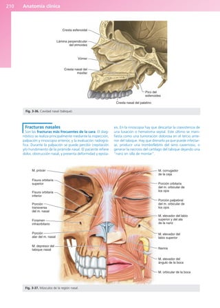 Anatomía clínica
210
Fracturas nasales
Son las fracturas más frecuentes de la cara. El diag-
nóstico se realiza principalmente mediante la inspección,
palpación y rinoscopia anterior, y la evaluación radiográ-
fica. Durante la palpación se puede percibir crepitación
y/o hundimiento de la pirámide nasal. El paciente refiere
dolor, obstrucción nasal, y presenta deformidad y epista-
xis. En la rinoscopia hay que descartar la coexistencia de
una luxación o hematoma septal. Este último se mani-
fiesta como una tumoración dolorosa en el tercio ante-
rior del tabique. Hay que drenarlo ya que puede infectar-
se, producir una tromboflebitis del seno cavernoso, o
generar la necrosis del cartílago del tabique dejando una
“nariz en silla de montar”.
Cresta esfenoidal
Lámina perpendicular
del etmoides
Vómer
Cresta nasal del
maxilar
Cresta nasal del palatino
Pico del
esfenoides
Fig. 3-36. Cavidad nasal (tabique).
M. prócer
Fisura orbitaria
superior
Fisura orbitaria
inferior
Porción
transversa
del m. nasal
Foramen
infraorbitario
Porción
alar del m. nasal
M. depresor del
tabique nasal
M. orbicular de la boca
M. elevador del
ángulo de la boca
Narina
M. elevador del
labio superior
M. elevador del labio
superior y del ala
de la nariz
Porción palpebral
del m. orbicular de
los ojos
Porción orbitaria
del m. orbicular de
los ojos
M. corrugador
de la ceja
Fig. 3-37. Músculos de la región nasal.
b027-03.qxd 7/12/11 2:36 PM Page 210
ERRNVPHGLFRVRUJ
 