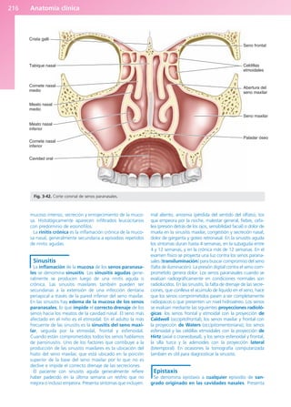 Anatomía clínica
216
mucoso intenso, secreción y enrojecimiento de la muco-
sa. Histológicamente aparecen infiltrados leucocitarios
con predominio de eosinófilos.
La rinitis crónica es la inflamación crónica de la muco-
sa nasal, generalmente secundaria a episodios repetidos
de rinitis agudas.
Sinusitis
La inflamación de la mucosa de los senos paranasa-
les se denomina sinusitis. Las sinusitis agudas gene-
ralmente se producen luego de una rinitis aguda o
crónica. Las sinusitis maxilares también pueden ser
secundarias a la extensión de una infección dentaria
periapical a través de la pared inferior del seno maxilar.
En las sinusitis hay edema de la mucosa de los senos
paranasales, lo que impide el correcto drenaje de los
senos hacia los meatos de la cavidad nasal. El seno más
afectado en el niño es el etmoidal. En el adulto la más
frecuente de las sinusitis es la sinusitis del seno maxi-
lar, seguida por la etmoidal, frontal y esfenoidal.
Cuando están comprometidos todos los senos hablamos
de pansinusitis. Uno de los factores que contibuye a la
producción de las sinusitis maxilares es la ubicación del
hiato del seno maxilar, que está ubicado en la porción
superior de la base del seno maxilar por lo que no es
declive e impide el correcto drenaje de las secreciones.
El paciente con sinusitis aguda generalmente refiere
haber padecido en la última semana un resfrío que no
mejora o incluso empeora. Presenta síntomas que incluyen:
mal aliento, anosmia (pérdida del sentido del olfato), tos
que empeora por la noche, malestar general, fiebre, cefa-
lea (presión detrás de los ojos, sensibilidad facial) o dolor de
muela en la sinusitis maxilar, congestión y secreción nasal,
dolor de garganta y goteo retronasal. En la sinusitis aguda
los síntomas duran hasta 4 semanas, en la subaguda entre
4 y 12 semanas, y en la crónica más de 12 semanas. En el
examen físico se proyecta una luz contra los senos parana-
sales (transiluminación) para buscar compromiso del seno
(falta de iluminación). La presión digital contra el seno com-
prometido genera dolor. Los senos paranasales cuando se
evalúan radiográficamente en condiciones normales son
radiolúcidos. En las sinusitis, la falta de drenaje de las secre-
ciones, que conlleva el acúmulo de líquido en el seno, hace
que los senos comprometidos pasen a ser completamente
radiopacos o que presenten un nivel hidroaéreo. Los senos
se evalúan mediante las siguientes proyecciones radioló-
gicas: los senos frontal y etmoidal con la proyección de
Caldwell (occipitofrontal); los senos maxilar y frontal con
la proyección de Waters (occipitomentoniana); los senos
esfenoidal y las celdillas etmoidales con la proyección de
Hirtz (axial o craneobasal), y los senos esfenoidal y frontal,
la silla turca y la adenoides con la proyección lateral
(bitemporal). En ocasiones la tomografía computarizada
también es útil para diagnosticar la sinusitis.
Epistaxis
Se denomina epistaxis a cualquier episodio de san-
grado originado en las cavidades nasales. Presenta
Paladar óseo
Seno maxilar
Abertura del
seno maxilar
Celdillas
etmoidales
Seno frontal
Crista galli
Tabique nasal
Cornete nasal
medio
Meato nasal
medio
Meato nasal
inferior
Cornete nasal
inferior
Cavidad oral
Fig. 3-42. Corte coronal de senos paranasales.
b027-03.qxd 7/12/11 2:37 PM Page 216
ERRNVPHGLFRVRUJ
 