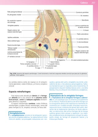 Cabeza 257
ria carótida externa (antes de ingresar en el comparti-
mento glandular), nodos linfáticos, y el tronco simpático
cervical.
Espacio retrofaríngeo
Este espacio está ubicado por detrás de la faringe,
por delante de la cara anterior de la columna verte-
bral cervical, y entre los tabiques sagitales retrofarín-
geos derecho e izquierdo.
El espacio retrofaríngeo contiene: nodos linfáticos
retrofaríngeos, el plexo venoso retrofaríngeo, ramos del
plexo faríngeo (X, IX, simpático cervical) y la fascia alar.
Amigdalectomía
La amigdalectomía consiste en la extirpación quirúr-
gica de las amígdalas palatinas. Se realiza tanto en niños
como en adultos. Las principales indicaciones son: ron-
quidos y apneas del sueño; amigdalitis recurrente; ante-
cedente de dos o más abscesos periamigdalinos; halito-
sis (mal aliento) que no responde a otros tratamientos. El
posoperatorio requiere medidas básicas como: una dieta
blanda y fría y la utilización de antibióticos y analgésicos.
Hiperplasia de la amígdala faríngea
La hiperplasia de la amígdala faríngea o adenoi-
des es una patología que se presenta principalmente
en la infancia. Produce la obstrucción de la faringe con
la consiguiente obstrucción nasal que se manifiesta clí-
nicamente con: rinolalia cerrada, ronquidos nocturnos,
respiración bucal, síndrome de apneas del sueño, alte-
ración de la implantación dentaria y la facies adenoi-
dea. La obstrucción del orificio faríngeo de la trompa
auditiva genera otitis serosas a repetición. Los méto-
dos complementarios de diagnóstico incluyen la radio-
grafía simple de faringe en proyección lateral y la
endoscopia flexible.
Conducto parotídeo
M. masetero
Lámina superficial de
la fascia cervical
N. facial
A. carótida externa
V. retromandibular
Tejido subcutáneo
Fascia parotídea
Región posterior del
espacio laterofaríngeo
M. esternocleidomastoideo
M. digástrico
Mandíbula
M. pterigoideo medial
Amígdala palatina
Región anterior del
espacio laterofaríngeo
Apófisis estiloides
Aleta estilofaríngea
M. constrictor superior
de la faringe
Fascia bucofaríngea
Tabique sagital
retrovisceral
2a vértebra cervical
Lámina prevertebral de
la fascia cervical
V. yugular interna
A. carótida interna
Tronco simpático cervical
N. hipogloso
N. vago N. accesorio
N. glosofaríngeo
Nodo linfático
Rafe pterigomandibular
Fig. 3-78. Esquema del espacio perifaríngeo. Corte horizontal a nivel de la segunda vértebra cervical que pasa por la glándula
parótida. Vista superior.
b027-03.qxd 7/12/11 2:37 PM Page 257
ERRNVPHGLFRVRUJ
 