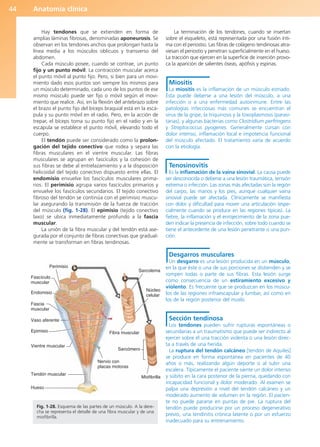Anatomía clínica
44
Hay tendones que se extienden en forma de
amplias láminas fibrosas, denominadas aponeurosis. Se
observan en los tendones anchos que prolongan hasta la
línea media a los músculos oblicuos y transverso del
abdomen.
Cada músculo posee, cuando se contrae, un punto
fijo y un punto móvil. La contracción muscular acerca
el punto móvil al punto fijo. Pero, si bien para un movi-
miento dado esos puntos son siempre los mismos para
un músculo determinado, cada uno de los puntos de ese
mismo músculo puede ser fijo o móvil según el movi-
miento que realice. Así, en la flexión del antebrazo sobre
el brazo el punto fijo del bíceps braquial está en la escá-
pula y su punto móvil en el radio. Pero, en la acción de
trepar, el bíceps toma su punto fijo en el radio y en la
escápula se establece el punto móvil, elevando todo el
cuerpo.
El tendón puede ser considerado como la prolon-
gación del tejido conectivo que rodea y separa las
fibras musculares en el vientre muscular. Las fibras
musculares se agrupan en fascículos y la cohesión de
sus fibras se debe al entrelazamiento y a la disposición
helicoidal del tejido conectivo dispuesto entre ellas. El
endomisio envuelve los fascículos musculares prima-
rios. El perimisio agrupa varios fascículos primarios y
envuelve los fascículos secundarios. El tejido conectivo
fibroso del tendón se continúa con el perimisio muscu-
lar asegurando la transmisión de la fuerza de tracción
del músculo (fig. 1-28). El epimisio (tejido conectivo
laxo) se ubica inmediatamente profundo a la fascia
muscular.
La unión de la fibra muscular y del tendón está ase-
gurada por el conjunto de fibras conectivas que gradual-
mente se transforman en fibras tendinosas.
La terminación de los tendones, cuando se insertan
sobre el esqueleto, está representada por una fusión ínti-
ma con el periostio. Las fibras de colágeno tendinosas atra-
viesan el periostio y penetran superficialmente en el hueso.
La tracción que ejercen en la superficie de inserción provo-
ca la aparición de salientes óseas, apófisis y espinas.
Miositis
La miositis es la inflamación de un músculo estriado.
Ésta puede deberse a una lesión del músculo, a una
infección o a una enfermedad autoinmune. Entre las
patologías infecciosas más comunes se encuentran el
virus de la gripe, la triquinosis y la toxoplasmosis (parasi-
tarias), y algunas bacterias como Clostridium perfringens
y Streptococcus pyogenes. Generalmente cursan con
dolor intenso, inflamación local e impotencia funcional
del músculo afectado. El tratamiento varía de acuerdo
con la etiología.
Tenosinovitis
Es la inflamación de la vaina sinovial. La causa puede
ser desconocida o deberse a una lesión traumática, tensión
extrema o infección. Las zonas más afectadas son la región
del carpo, las manos y los pies, aunque cualquier vaina
sinovial puede ser afectada. Clínicamente se manifiesta
con dolor y dificultad para mover una articulación (espe-
cialmente cuando se produce en las regiones típicas). La
fiebre, la inflamación y el enrojecimiento de la zona pue-
den indicar la presencia de infección, sobre todo cuando se
tiene el antecedente de una lesión penetrante o una pun-
ción.
Desgarros musculares
Un desgarro es una lesión producida en un músculo,
en la que éste o una de sus porciones se distienden y se
rompen todas o parte de sus fibras. Esta lesión surge
como consecuencia de un estiramiento excesivo y
violento. Es frecuente que se produzcan en los múscu-
los de las regiones infraescapular y lumbar, así como en
los de la región posterior del muslo.
Sección tendinosa
Los tendones pueden sufrir rupturas espontáneas o
secundarias a un traumatismo que puede ser indirecto al
ejercer sobre él una tracción violenta o una lesión direc-
ta a través de una herida.
La ruptura del tendón calcáneo [tendón de Aquiles]
se produce en forma espontánea en pacientes de 40
años o más, realizando algún deporte o al subir una
escalera. Típicamente el paciente siente un dolor intenso
y súbito en la cara posterior de la pierna, quedando con
incapacidad funcional y dolor moderado. Al examen se
palpa una depresión a nivel del tendón calcáneo y un
moderado aumento de volumen en la región. El pacien-
te no puede pararse en puntas de pie. La ruptura del
tendón puede producirse por un proceso degenerativo
previo, una tendinitis crónica latente o por un esfuerzo
inadecuado para su entrenamiento.
Sarcómero
Núcleo
celular
Sarcolema
Miofibrilla
Nervio con
placas motoras
Fibra muscular
Hueso
Tendón muscular
Vientre muscular
Epimisio
Vaso aferente
Fascia
muscular
Endomisio
Fascículo
muscular
Perimisio
Fig. 1-28. Esquema de las partes de un músculo. A la dere-
cha se representa el detalle de una fibra muscular y de una
miofibrilla.
b027-01.qxd 7/14/11 12:49 PM Page 44
ERRNVPHGLFRVRUJ
 