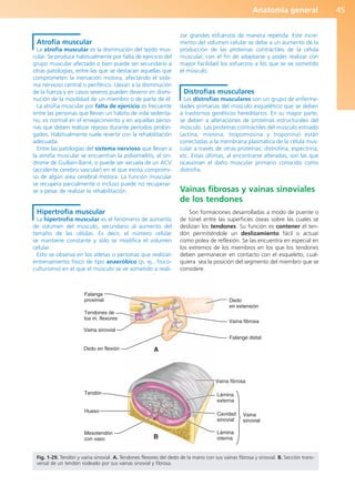 Anatomía general 45
Atrofia muscular
La atrofia muscular es la disminución del tejido mus-
cular. Se produce habitualmente por falta de ejercicio del
grupo muscular afectado o bien puede ser secundario a
otras patologías, entre las que se destacan aquellas que
comprometen la inervación motora, afectando el siste-
ma nervioso central o periférico. Llevan a la disminución
de la fuerza y en casos severos pueden devenir en dismi-
nución de la movilidad de un miembro o de parte de él.
La atrofia muscular por falta de ejercicio es frecuente
entre las personas que llevan un hábito de vida sedenta-
rio, es normal en el envejecimiento y en aquellas perso-
nas que deben realizar reposo durante períodos prolon-
gados. Habitualmente suele revertir con la rehabilitación
adecuada.
Entre las patologías del sistema nervioso que llevan a
la atrofia muscular se encuentran la poliomielitis, el sín-
drome de Guillain-Barré, o puede ser secuela de un ACV
(accidente cerebro vascular) en el que exista compromi-
so de algún área cerebral motora. La función muscular
se recupera parcialmente o incluso puede no recuperar-
se a pesar de realizar la rehabilitación.
Hipertrofia muscular
La hipertrofia muscular es el fenómeno de aumento
de volumen del músculo, secundario al aumento del
tamaño de las células. Es decir, el número celular
se mantiene constante y sólo se modifica el volumen
celular.
Esto se observa en los atletas o personas que realizan
entrenamiento físico de tipo anaeróbico (p. ej., fisico-
culturismo) en el que el músculo se ve sometido a reali-
zar grandes esfuerzos de manera repetida. Este incre-
mento del volumen celular se debe a un aumento de la
producción de las proteínas contráctiles de la célula
muscular, con el fin de adaptarse y poder realizar con
mayor facilidad los esfuerzos a los que se ve sometido
el músculo.
Distrofias musculares
Las distrofias musculares son un grupo de enferme-
dades primarias del músculo esquelético que se deben
a trastornos genéticos hereditarios. En su mayor parte,
se deben a alteraciones de proteínas estructurales del
músculo. Las proteínas contráctiles del músculo estriado
(actina, miosina, tropomiosina y troponina) están
conectadas a la membrana plasmática de la célula mus-
cular a través de otras proteínas: distrofina, espectrina,
etc. Estas últimas, al encontrarse alteradas, son las que
ocasionan el daño muscular primario conocido como
distrofia.
Vainas fibrosas y vainas sinoviales
de los tendones
Son formaciones desarrolladas a modo de puente o
de túnel entre las superficies óseas sobre las cuales se
deslizan los tendones. Su función es contener el ten-
dón permitiéndole un deslizamiento fácil o actuar
como polea de reflexión. Se las encuentra en especial en
los extremos de los miembros en los que los tendones
deben permanecer en contacto con el esqueleto, cual-
quiera sea la posición del segmento del miembro que se
considere.
Falange
proximal
Tendones de
los m. flexores
Vaina sinovial
Dedo en flexión
Dedo
en extensión
Vaina fibrosa
Falange distal
A
Tendón
Hueso
Mesotendón
con vaso
Vaina fibrosa
Lámina
externa
Cavidad
sinovial
Lámina
interna
Vaina
sinovial
B
Fig. 1-29. Tendón y vaina sinovial. A. Tendones flexores del dedo de la mano con sus vainas fibrosa y sinovial. B. Sección trans-
versal de un tendón rodeado por sus vainas sinovial y fibrosa.
b027-01.qxd 7/14/11 12:49 PM Page 45
ERRNVPHGLFRVRUJ
 