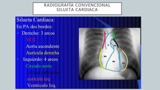 RADIOGRAFÍA CONVENCIONAL
SILUETA CARDIACA
21
 