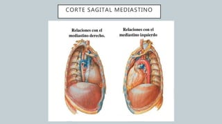 CORTE SAGITAL MEDIASTINO
 