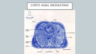 CORTE AXIAL MEDIASTINO
 