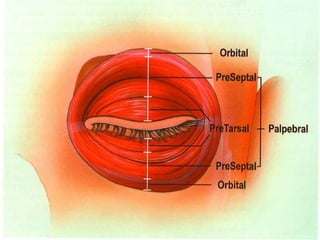 Orbita Rrethor ANATOMIA DE LA ORBITA. CLASE DE OFTALMOLOGIA | PPTX