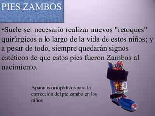 PIES ZAMBOS

•Suele ser necesario realizar nuevos "retoques"
quirúrgicos a lo largo de la vida de estos niños; y
a pesar de todo, siempre quedarán signos
estéticos de que estos pies fueron Zambos al
nacimiento.

          Aparatos ortopédicos para la
          corrección del pie zambo en los
          niños
 