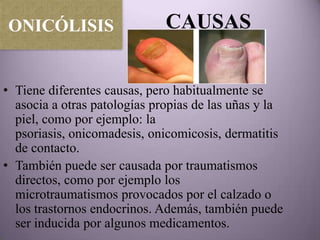 ONICÓLISIS                    CAUSAS


• Tiene diferentes causas, pero habitualmente se
  asocia a otras patologías propias de las uñas y la
  piel, como por ejemplo: la
  psoriasis, onicomadesis, onicomicosis, dermatitis
  de contacto.
• También puede ser causada por traumatismos
  directos, como por ejemplo los
  microtraumatismos provocados por el calzado o
  los trastornos endocrinos. Además, también puede
  ser inducida por algunos medicamentos.
 