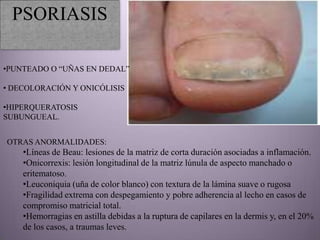 PSORIASIS

•PUNTEADO O “UÑAS EN DEDAL”

• DECOLORACIÓN Y ONICÓLISIS

•HIPERQUERATOSIS
SUBUNGUEAL.


OTRAS ANORMALIDADES:
    •Líneas de Beau: lesiones de la matriz de corta duración asociadas a inflamación.
    •Onicorrexis: lesión longitudinal de la matriz lúnula de aspecto manchado o
    eritematoso.
    •Leuconiquia (uña de color blanco) con textura de la lámina suave o rugosa
    •Fragilidad extrema con despegamiento y pobre adherencia al lecho en casos de
    compromiso matricial total.
    •Hemorragias en astilla debidas a la ruptura de capilares en la dermis y, en el 20%
    de los casos, a traumas leves.
 