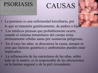 PSORIASIS                     CAUSAS
• La psoriasis es una enfermedad hereditaria, por
  lo que se transmite genéticamente, de padres a hijos.
• Los médicos piensan que probablemente ocurre
  cuando el sistema inmunitario del cuerpo toma
  erróneamente células sanas por sustancias peligrosas.
• En el caso las uñas, se desconoce la causa, aunque se
  cree que factores genéricos y ambientales pueden estar
  implicados.
• La inflamación de las estructuras de las uñas, sobre
  todo de la matriz, es la responsable de las alteraciones
  en la lámina ungueal y de la piel circundante.
 