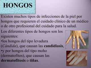HONGOS
Existen muchos tipos de infecciones de la piel por
hongos que requieren el cuidado clínico de un médico
o de otro profesional del cuidado para la salud.
Los diferentes tipos de hongos son los
siguientes:
•los hongos del tipo levadura
(Cándida), que causan las candidiasis,
•y por hongos del tipo moho
(dermatofitos), que causan las
dermatofitosis o tiñas.
 