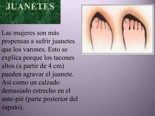 JUANETES

Las mujeres son más
propensas a sufrir juanetes
que los varones. Esto se
explica porque los tacones
altos (a partir de 4 cm)
pueden agravar el juanete.
Así como un calzado
demasiado estrecho en el
ante-pié (parte posterior del
zapato).
 