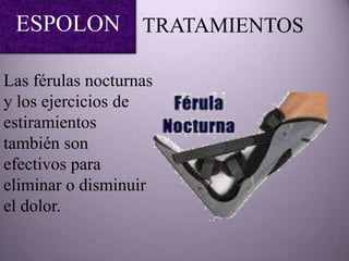 ESPOLON TRATAMIENTOS

Las férulas nocturnas
y los ejercicios de
estiramientos
también son
efectivos para
eliminar o disminuir
el dolor.
 