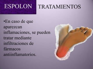 ESPOLON TRATAMIENTOS

•En caso de que
aparezcan
inflamaciones, se pueden
tratar mediante
infiltraciones de
fármacos
antiinflamatorios.
 