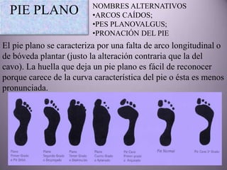 NOMBRES ALTERNATIVOS
  PIE PLANO               •ARCOS CAÍDOS;
                          •PES PLANOVALGUS;
                          •PRONACIÓN DEL PIE
El pie plano se caracteriza por una falta de arco longitudinal o
de bóveda plantar (justo la alteración contraria que la del
cavo). La huella que deja un pie plano es fácil de reconocer
porque carece de la curva característica del pie o ésta es menos
pronunciada.
 