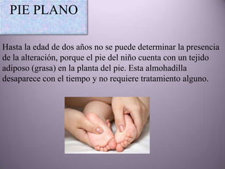 PIE PLANO

Hasta la edad de dos años no se puede determinar la presencia
de la alteración, porque el pie del niño cuenta con un tejido
adiposo (grasa) en la planta del pie. Esta almohadilla
desaparece con el tiempo y no requiere tratamiento alguno.
 