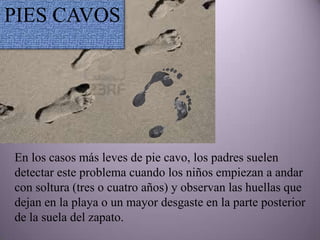 PIES CAVOS




En los casos más leves de pie cavo, los padres suelen
detectar este problema cuando los niños empiezan a andar
con soltura (tres o cuatro años) y observan las huellas que
dejan en la playa o un mayor desgaste en la parte posterior
de la suela del zapato.
 