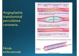 Anatomía del corazón