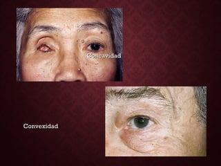 ConcavidadConcavidad
ConvexidadConvexidad
 