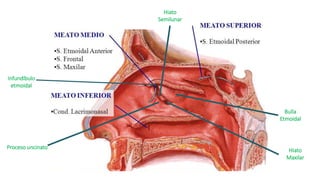 Infundíbulo
etmoidal
Hiato
Maxilar
Proceso uncinato
Bulla
Etmoidal
Hiato
Semilunar
 