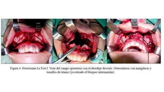 Anatomía de nariz y senos pn