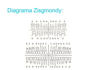 Diagrama Zisgmondy:
 