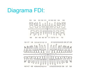 Diagrama FDI:
 